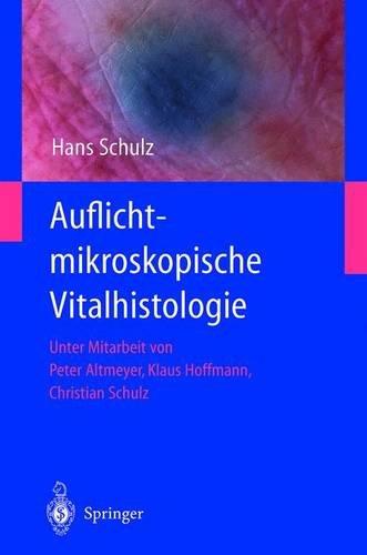 Auflichtmikroskopische Vitalhistologie: Dermatologischer Leitfaden