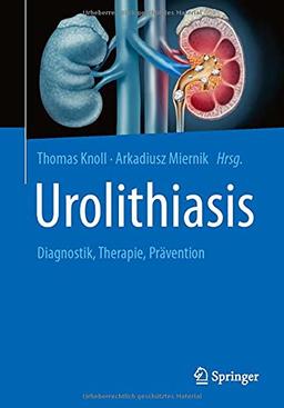 Urolithiasis: Diagnostik, Therapie, Prävention