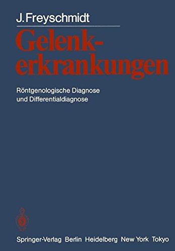 Gelenkerkrankungen: Röntgenologische Diagnose und Differentialdiagnose (German Edition)