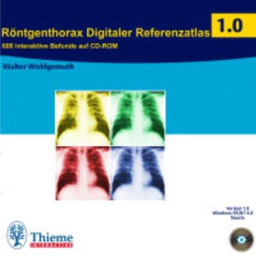 Röntgenthorax Digitaler Referenzatlas 1.0, 1 CD-ROM 600 interaktive Befunde auf CD-ROM. Für Windows 95/98/NT 4.0 u. MacOS