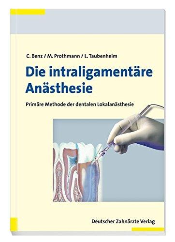 Die intraligamentäre Anästhesie: Primäre Methode der dentalen Lokalanästhesie