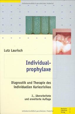 Individualprophylaxe: Diagnostik und Therapie des individuellen Kariesrisikos