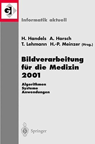 Bildverarbeitung für die Medizin 2001 (Informatik aktuell)