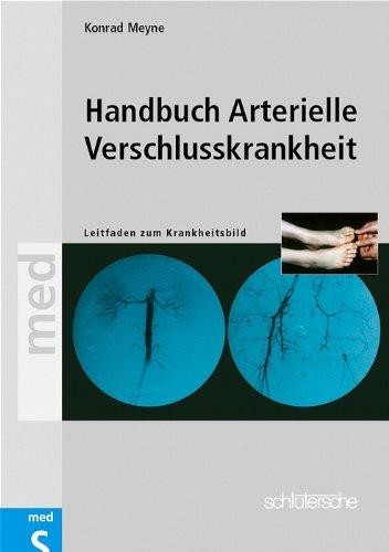 Handbuch Arterielle Verschlußkrankheiten. Leitfaden zum Krankheitsbild