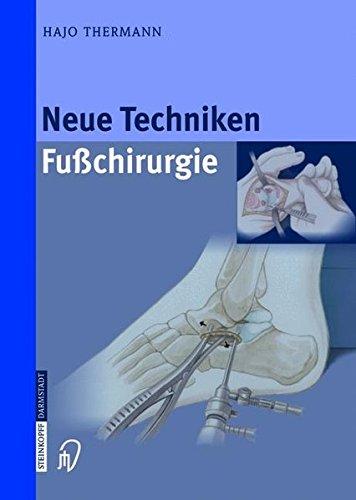 Neue Techniken Fusschirurgie