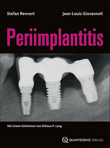 Periimplantitis