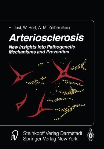 Arteriosclerosis: New Insights into Pathogenetic Mechanisms and Prevention