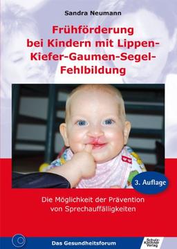 Frühförderung bei Kindern mit Lippen-Kiefer-Gaumen-Segel-Fehlbildung