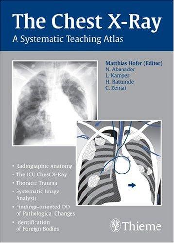 The Chest X-Ray: A Systematic Teaching Atlas