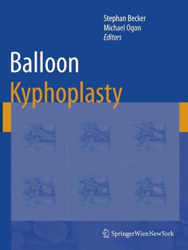 Balloon Kyphoplasty