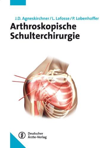 Arthroskopische Schulterchirurgie