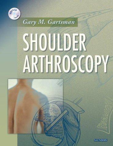 Shoulder Arthroscopy, w. CD-ROM