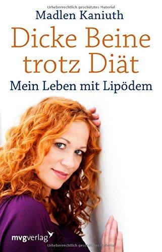 Dicke Beine trotz Diät: Mein Leben mit Lipödem