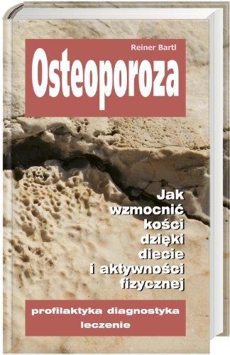 Osteoporoza: Jak wzmocnić kości dzięki diecie i aktywności fizycznej. Profilaktyka, diagnostyka, leczenie