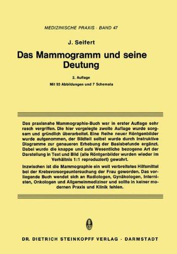 Das Mammogramm und Seine Deutung, Band 47 (Medizinische Praxis) (German Edition)