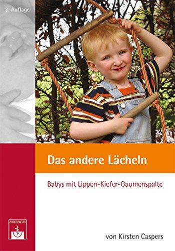 Das andere Lächeln: Babys mit Lippen-Kiefer-Gaumenspalte. Ein Buch (nicht nur) für Eltern