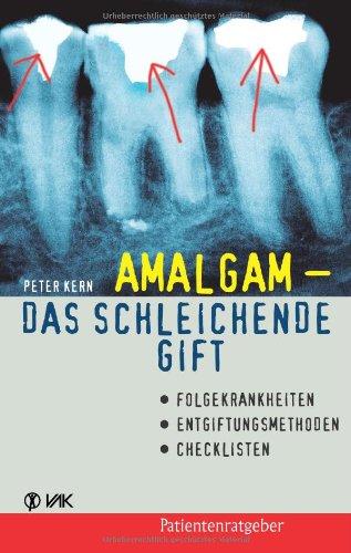 Amalgam - das schleichende Gift. Folgekrankheiten, Entgiftungsmethoden, Checklisten