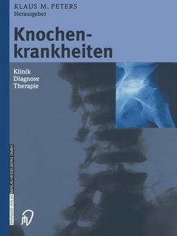 Knochenkrankheiten: Klinik Diagnose Therapie (German Edition)