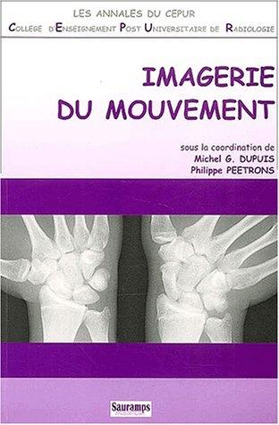 Imagerie du mouvement