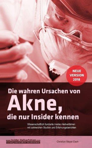 Die wahren Ursachen von Akne, die nur Insider kennen