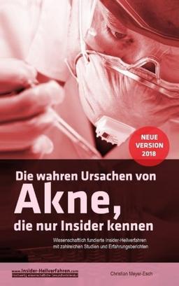 Die wahren Ursachen von Akne, die nur Insider kennen