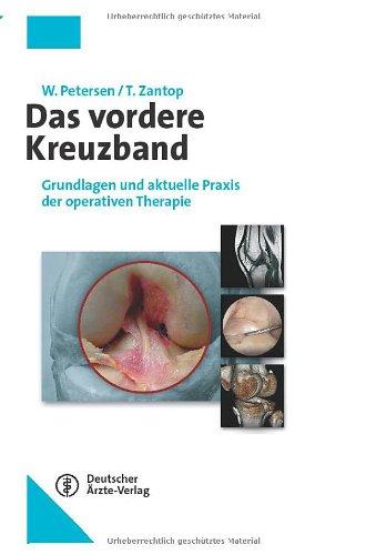 Das vordere Kreuzband: Grundlagen und aktuelle Praxis der operativen Therapie