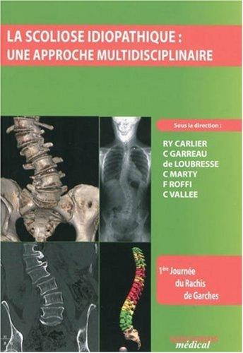 La scoliose idiopathique : une approche multidisciplinaire