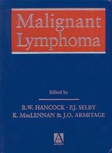 Malignant Lymphoma