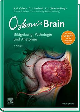 Osborn's Brain: Bildgebung, Pathologie und Anatomie