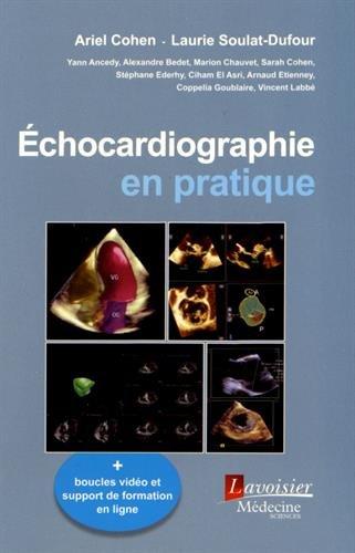 Echocardiographie en pratique