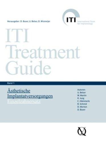 ITI Treatment Guide Band 1: Ästhetische Implantattherapie: Implantatbehandlungen in der ästhetischen Zone - Einzelkronen