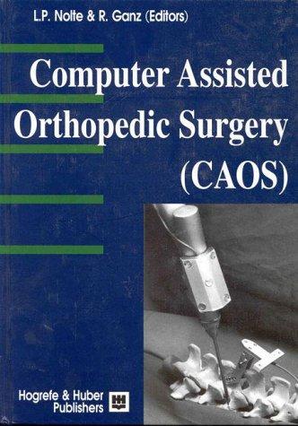 CAOS - Computer-Assisted Orthopedic Surgery