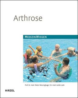 Arthrose