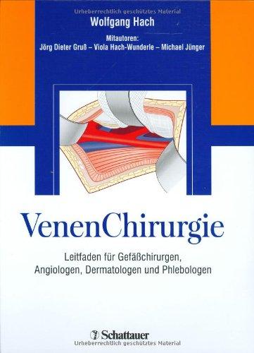 VenenChirurgie