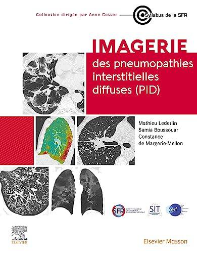 Imagerie des pneumopathies interstitielles diffuses (PID)