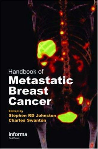 Handbook of Metastatic Breast Cancer