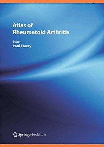 Atlas of Rheumatoid Arthritis