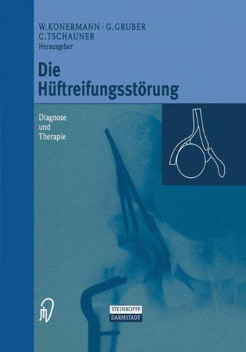 Die Hüftreifungsstörung: Diagnose und Therapie