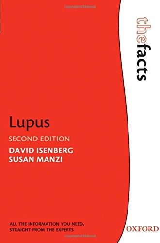 Lupus (The Facts)