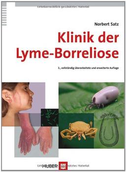 Klinik der Lyme-Borreliose