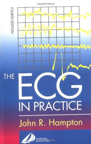 The ECG-Practice