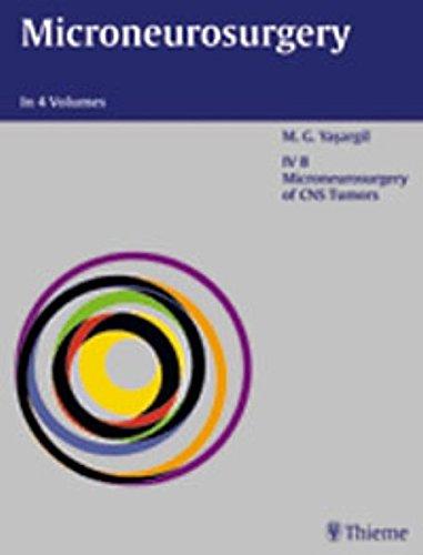 Microneurosurgery, 4 Vols., Vol.4B, Microneurosurgery of CNS Tumors