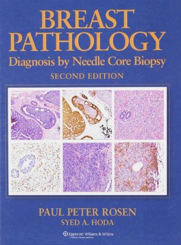 Breast Pathology: Diagnosis by Needle Core Biopsy