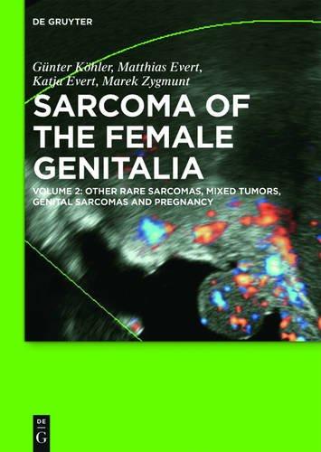 Sarcoma of the Female Genitalia: Other Rare Sarcomas, Mixed Tumors, Genital Sarcomas and Pregnancy: Volume 2: other rare sarcomas, mixed tumors, genital sarcomas and pregnancy