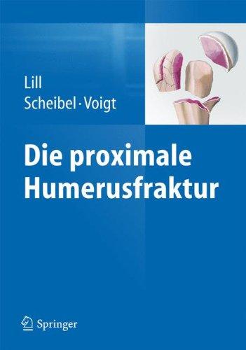 Die proximale Humerusfraktur