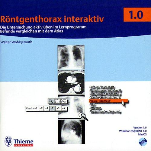 Röntgenthorax interaktiv 1.0, 1 CD-ROM Die Untersuchung aktiv üben mit dem Lernprogramm. Befunde vergleichen im Alltag. Für Windows 95/98/NT 4.0 und MacOS 8