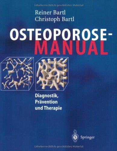 Osteoporose-Manual: Diagnostik, Prävention und Therapie