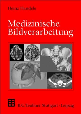 Medizinische Bildverarbeitung (XLeitfäden der Informatik)