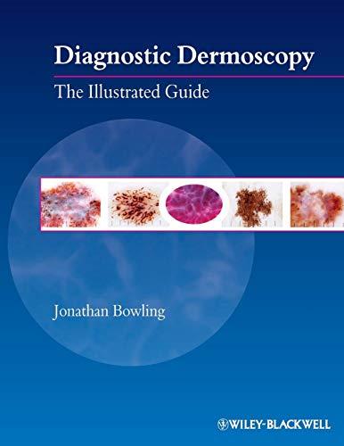 Diagnostic Dermoscopy: The Illustrated Guide