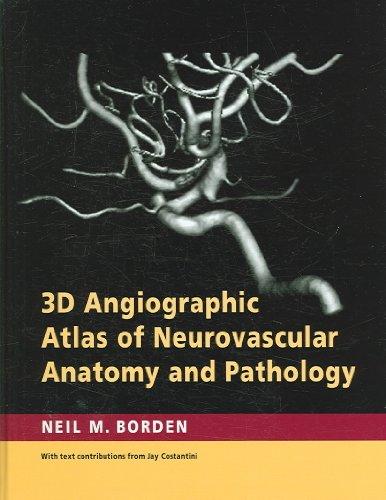 3D Angiographic Atlas of Neurovascular Anatomy and Pathology